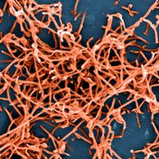 Ebola in Perspective